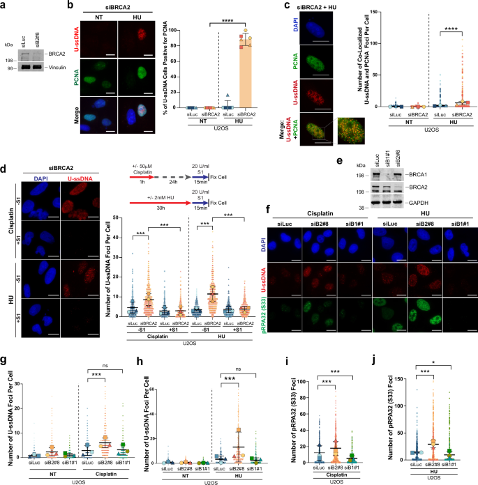 Fig. 2: Replication stress-induced ssDNA at stalled forks in BRCA2-, but not BRCA1- deficient cells, is a substrate for uracil accumulation.