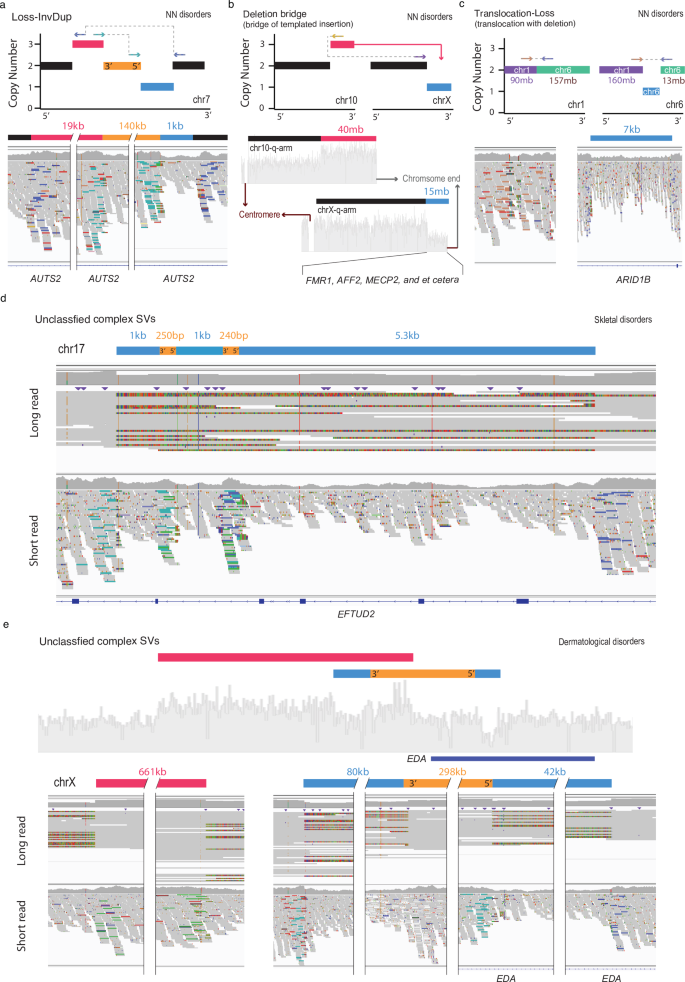 Fig. 3: Representative complex SVs disrupting potential causal genes.