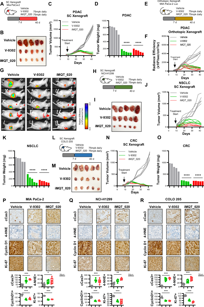 Fig. 5: Inhibition of mitochondrial SLC1A5_var inhibits cancer growth in vivo.