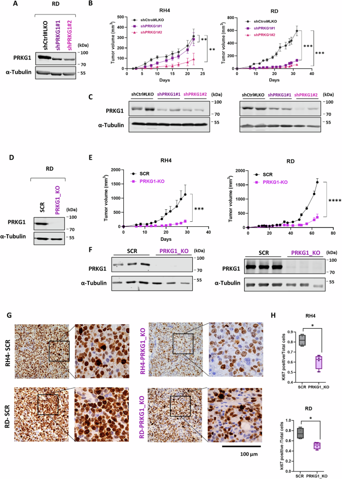 Fig. 4: PRKG1 is required for the growth of RMS tumor xenografts.
