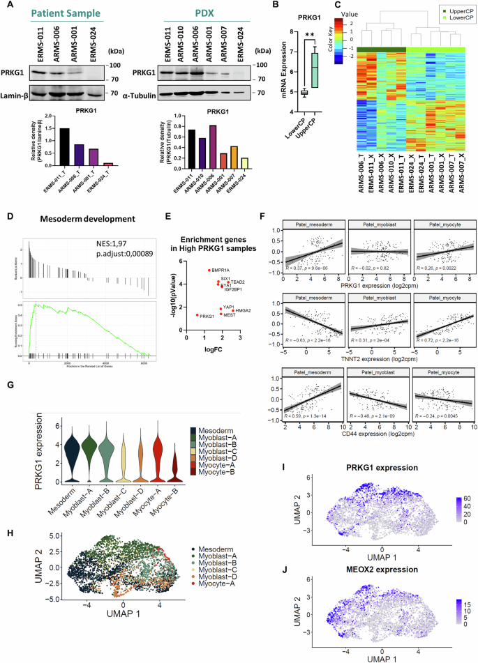 Fig. 7: PRKG1 is expressed in RMS with a mesodermal transcriptional profile.