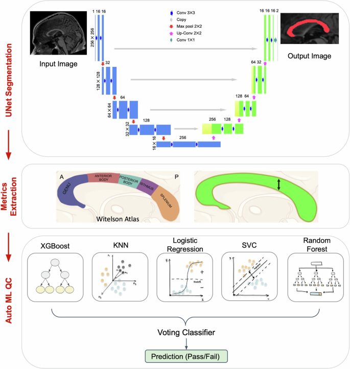Fig. 7: Segment, Measure, and AutoQC the midsagittal CC (SMACC) pipeline.