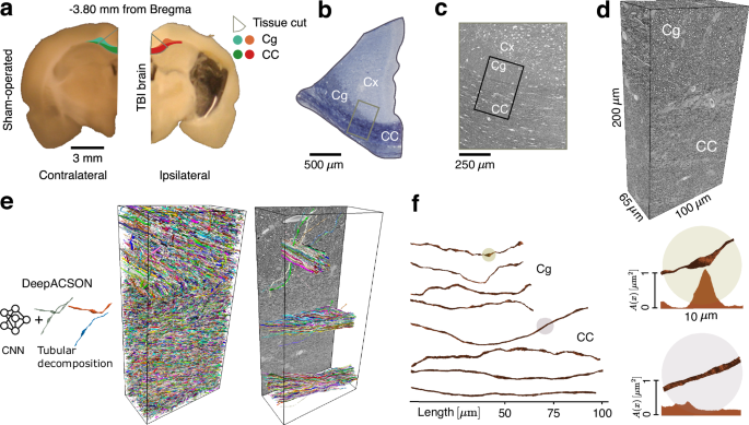 Fig. 1: Axon segmentation and morphology.