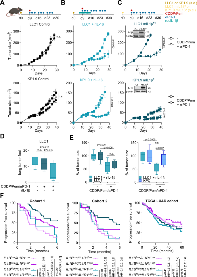 Fig. 1: IL-1β improves NSCLC response to chemo-immunotherapy.