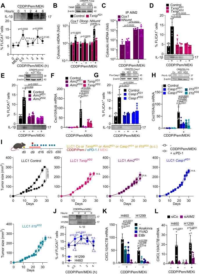 Fig. 6: TXNIP/AIM2/Caspase-1 drives IL-1β-mediated chemo-immunotherapy plus MEKi effects.
