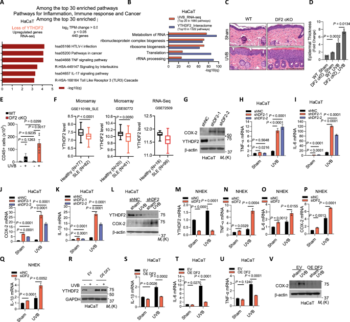 Fig. 1: YTHDF2 controls inflammatory gene expression.