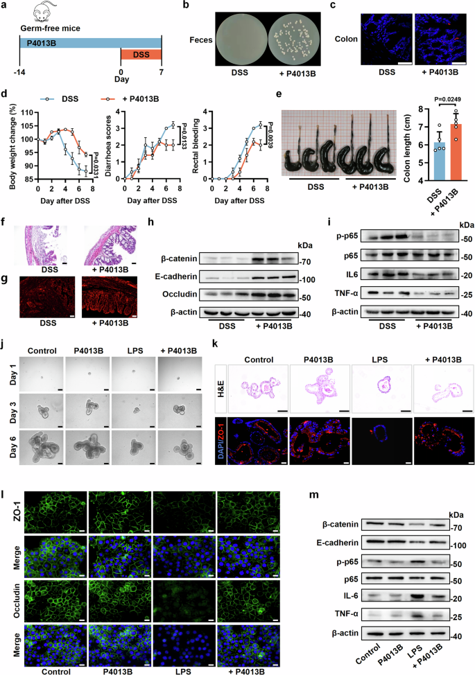Fig. 2: P4013B attenuates colitis independent of inherent gut microbiota.