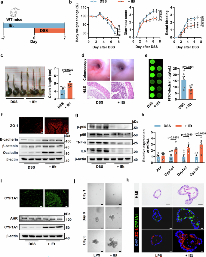 Fig. 5: IEt attenuates colitis in mice and colonic organoids.