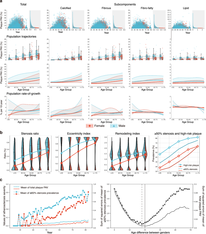 Fig. 4: Sex disparities in atherosclerosis onset and plaque progression.