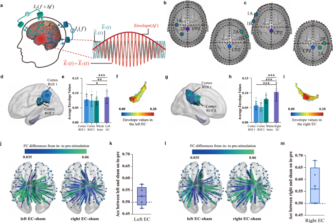 Fig. 3: MRI results of TI stimulation.
