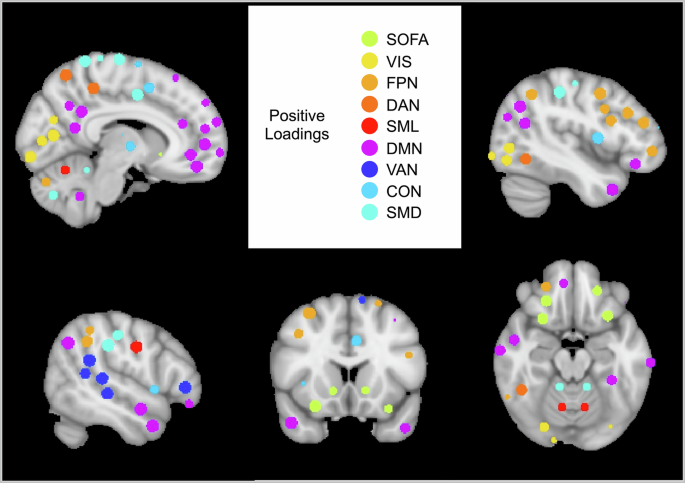 Fig. 3: Regions of interest in the networks with loadings onto the SOFA Between Network Connectivity Brain Signature.