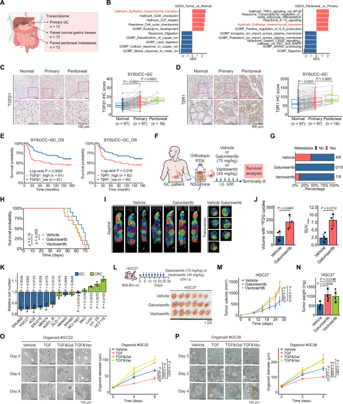 Fig. 1: Antagonizing TGFβ signaling failed to improve therapeutic outcomes in GC models.