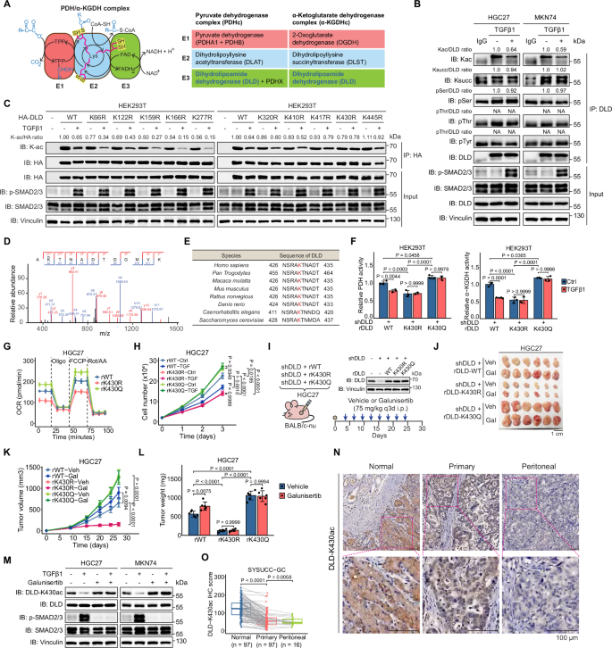 Fig. 3: DLD-K430 deacetylation mediates TGFβ-driven inhibition of PDH/α-KGDH and GC cell growth suppression.