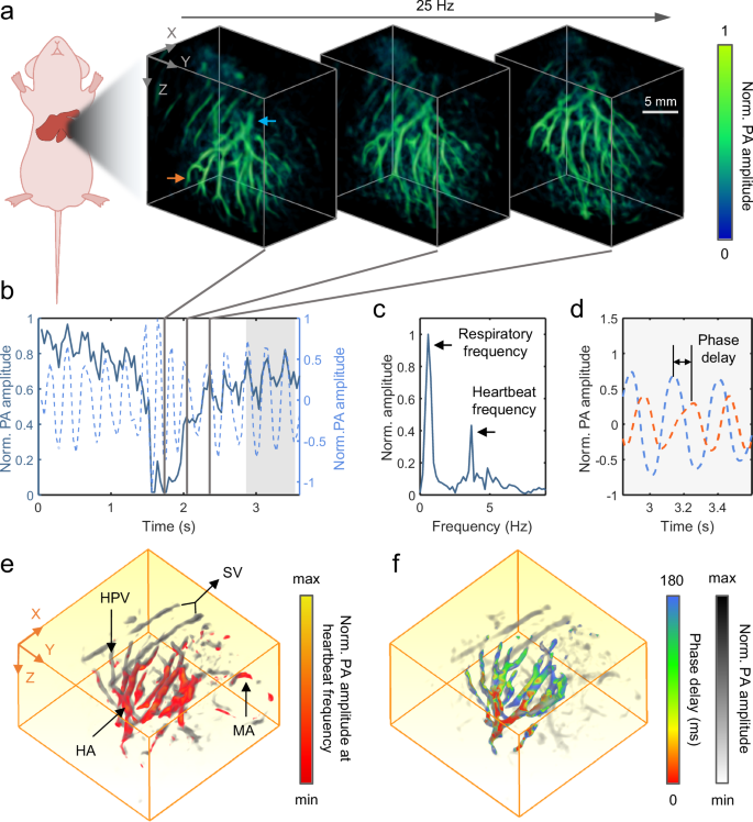Fig. 2: Real-time visualization of liver dynamics in 3D-PanoPACT.