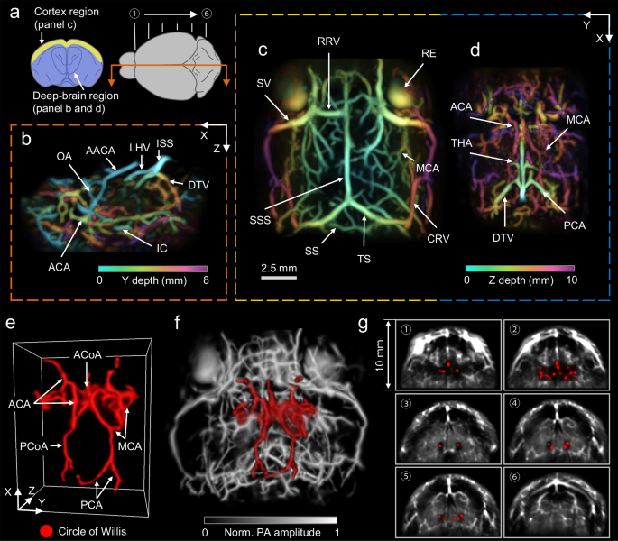 Fig. 3: Label-free whole-brain anatomy in 3D-PanoPACT.
