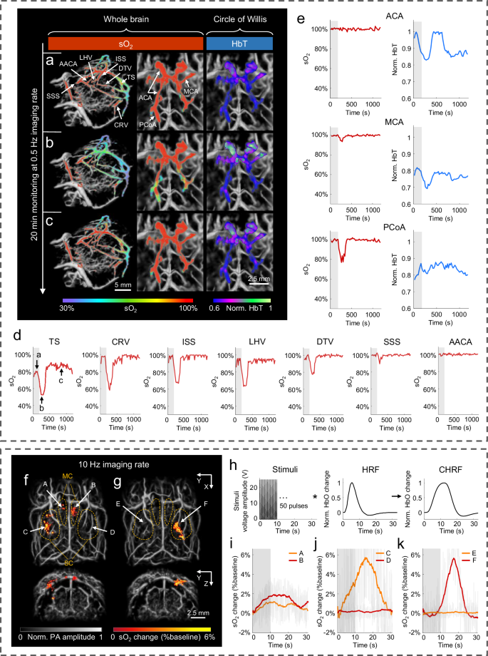 Fig. 4: Real-time monitoring of whole-brain functional dynamics in 3D-PanoPACT.