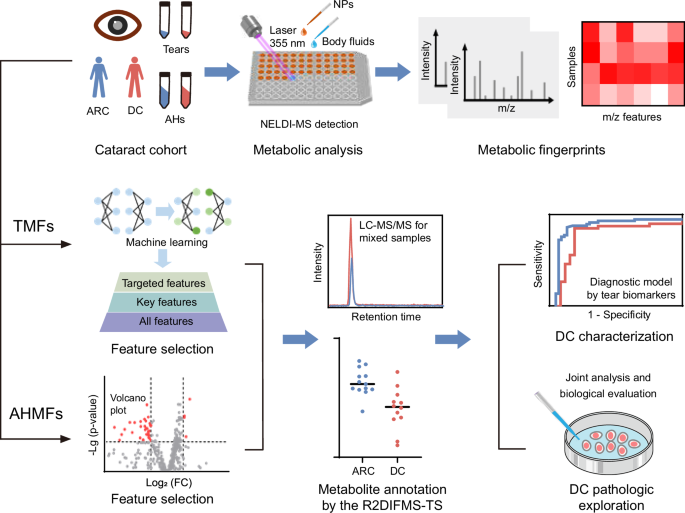 Fig. 1: The scheme for discovering metabolic biomarkers of DC in ocular fluids.