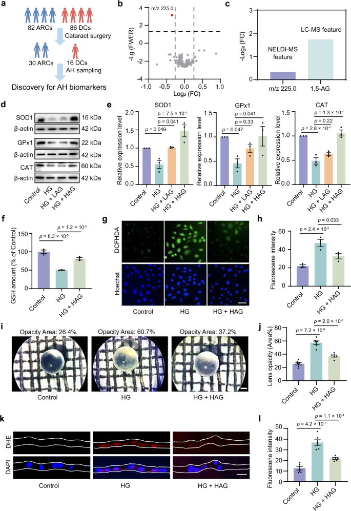 Fig. 5: Exploration for DC pathogenesis based on tear and AH biomarkers.
