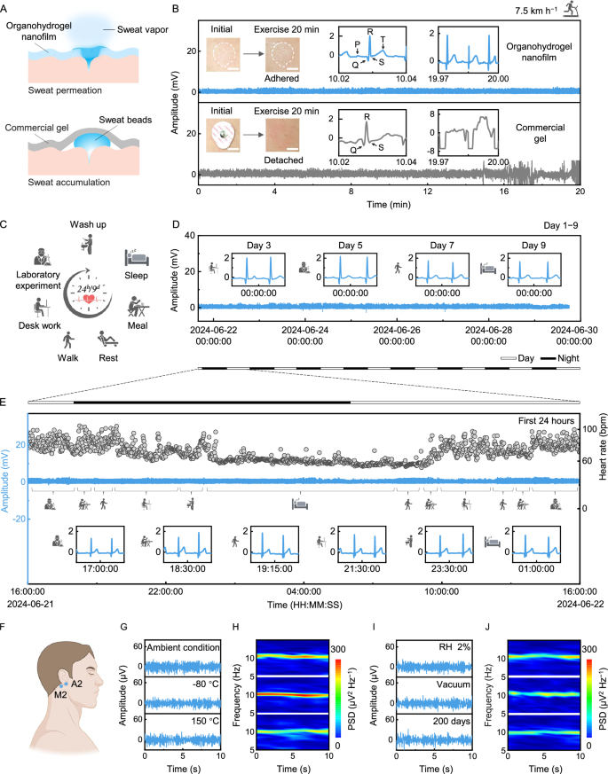 Fig. 5: Sweat and motion artifacts and long-term health monitoring using organohydrogel nanofilm electrodes.