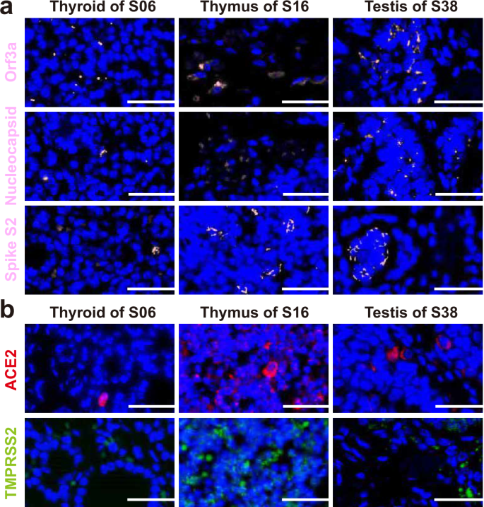 Fig. 3: Expression of SARS-CoV-2 proteins and key human receptors for its entry in fetal organs.