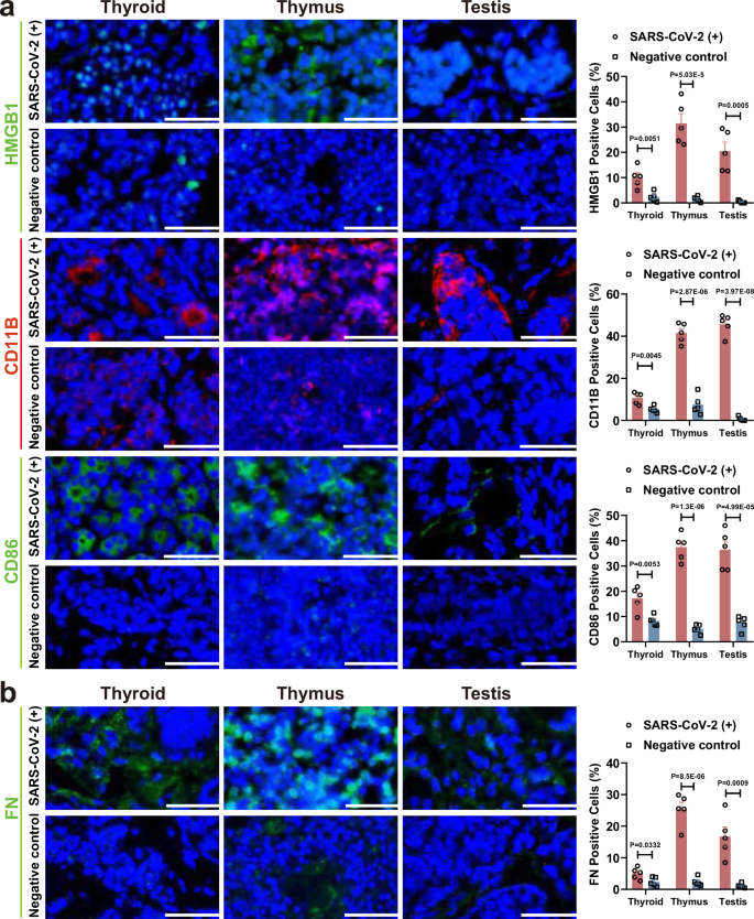 Fig. 4: IF analysis of markers associated with induced inflammation and fibrosis in SARS-CoV-2-infected fetal organs.