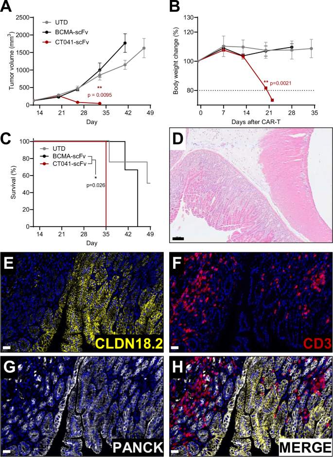 Fig. 2: Treatment with CT041-scFv CLDN18.2-targeted CAR T cells leads to intolerable on-target/off-tumor toxicity.