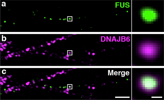 Fig. 3: FUS and DNAJB6 coincide in a subset of neuritic motor neuron granules.