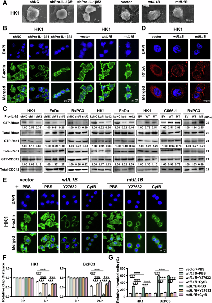 Fig. 3: High expression of Pro-IL-1β induces cytoskeletal remodeling through activation of RhoA/ROCK signaling.
