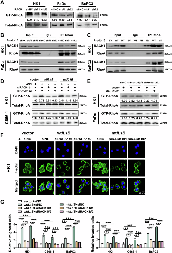 Fig. 5: Pro-IL-1β promotes activation of RhoA signaling and F-actin cytoskeleton remodeling via stabilization of RACK1 protein.