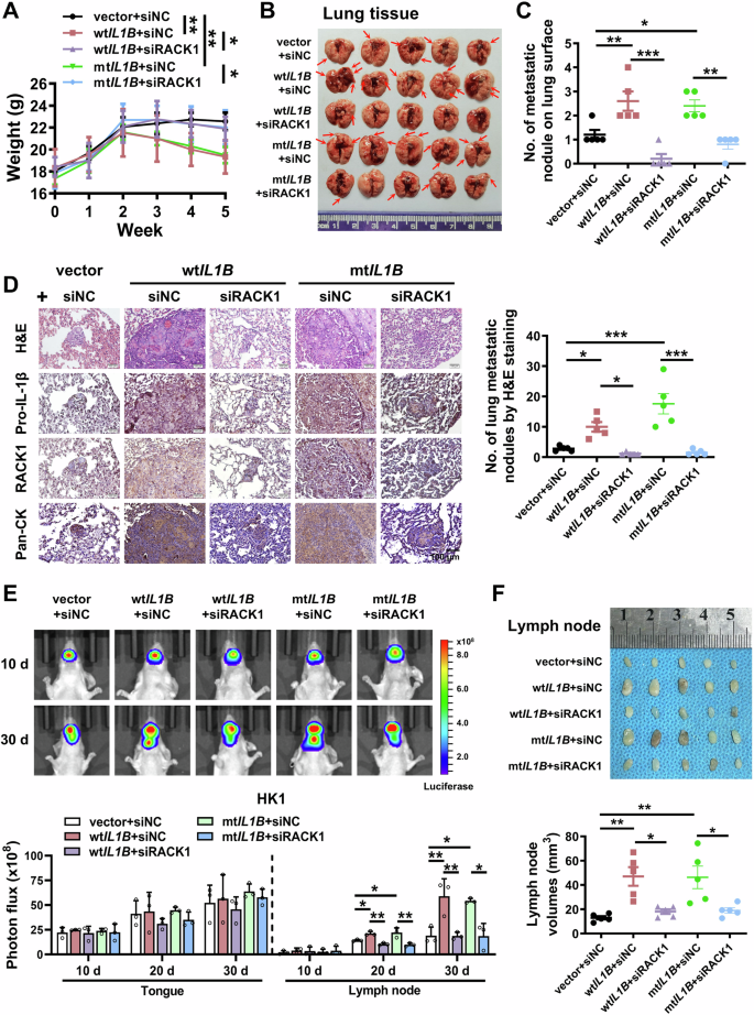 Fig. 6: Pro-IL-1β promotes metastasis of cancer cells via RACK1.