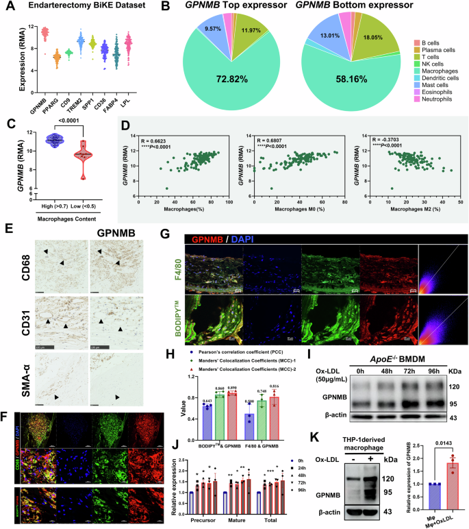 Fig. 2: GPNMB located specifically in macrophages of atherosclerotic plaques.