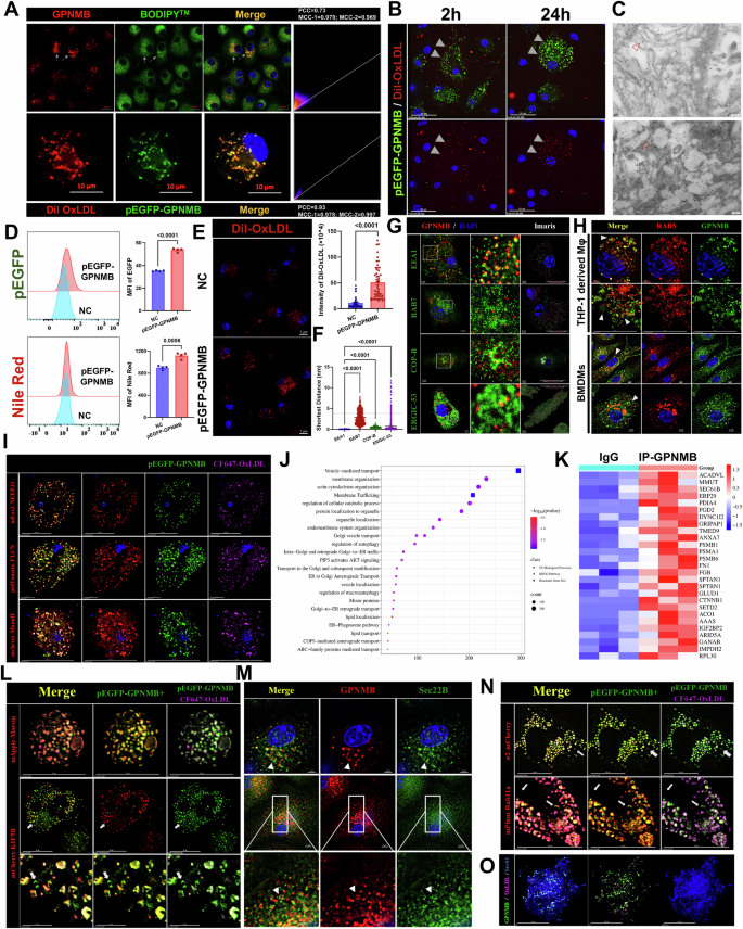 Fig. 5: GPNMB mediates the internalization, trafficking, and degradation of lipoprotein in macrophages.