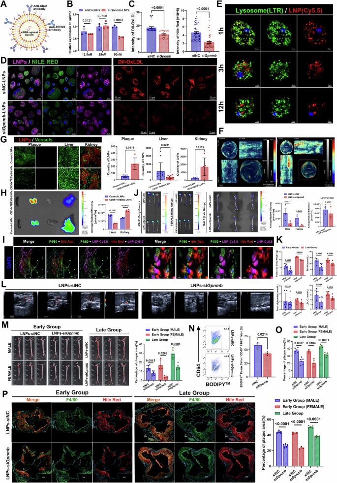 Fig. 8: siRNA lipid nanoparticles targeting Gpnmb in lesional macrophages alleviated atherosclerosis in mice.