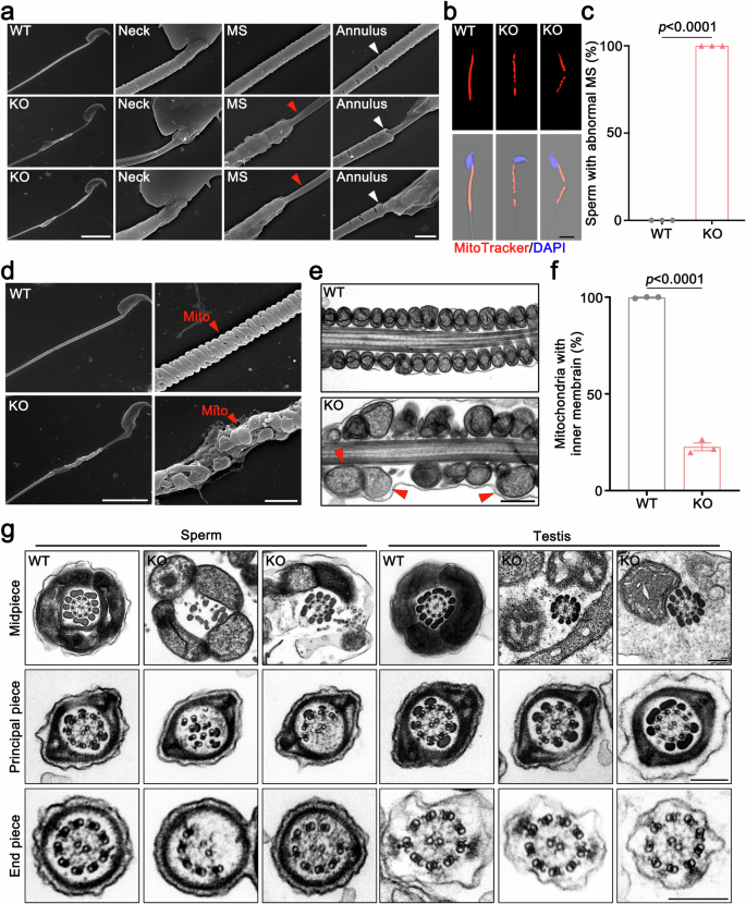 Fig. 3: Impaired mitochondrial sheath and mitochondrial inner membrane in Abhd10 KO spermatids revealed by electron microscopy.