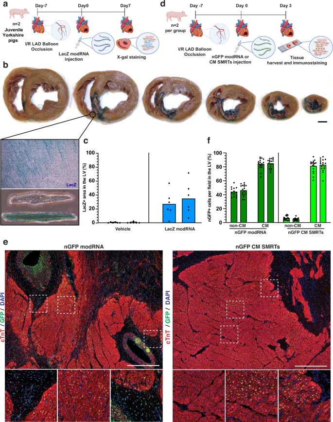 Fig. 1: CM SMRTs drove efficient, specific protein translation in CMs of porcine hearts after I/R injury.