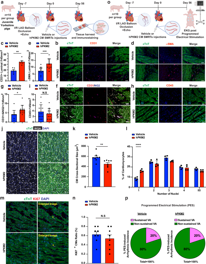 Fig. 4: hPKM2 CM SMRTs promoted angiogenesis, expanded mononuclear CM populations, reduced cardiomyocyte size and did not increase the risk of arrhythmia.