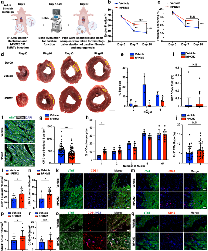 Fig. 5: Intramyocardially injected hPKM2 CM SMRTs improved cardiac function and reduced infarct size in an adult Sinclair minipig I/R model.