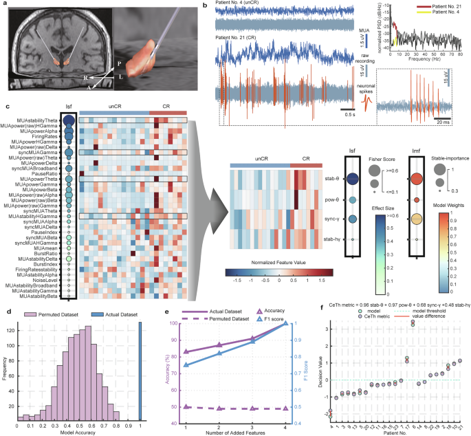 Fig. 1: Individualized prognosis for DoC using CeTh features.