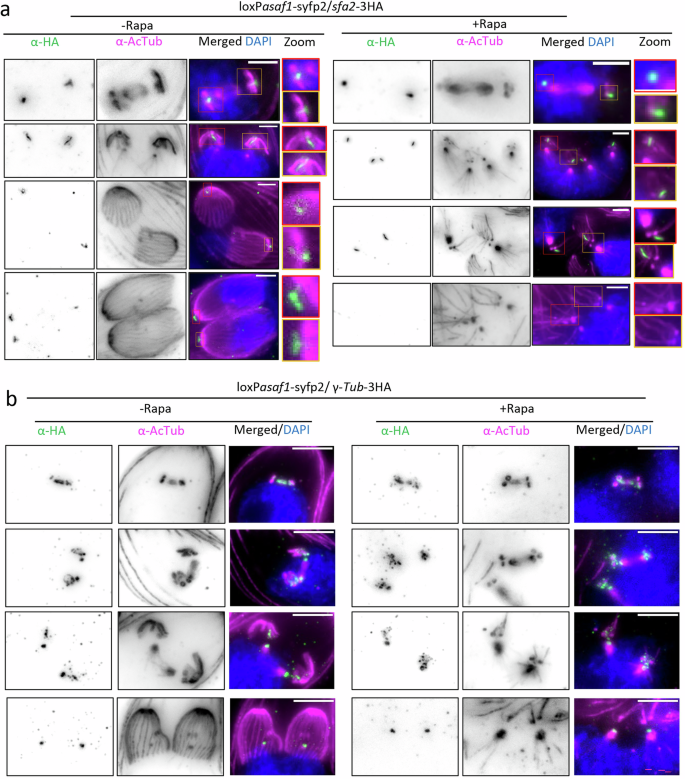 Fig. 5: ASAF1 depletion disrupts the localization of SFA2 and γ-tubulin during endodyogeny.