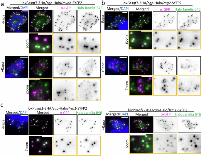Fig. 6: ASAF1 depletion disrupts the organization of the conoid complex.