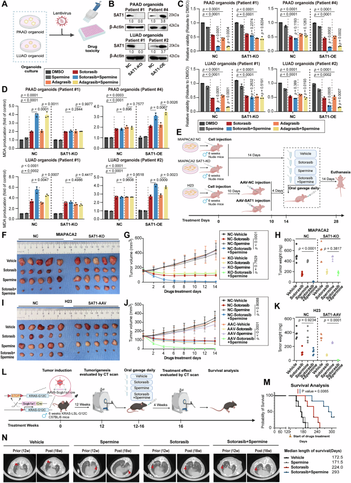 Fig. 6: Precisely targeting SAT1-mediated polyamine metabolism to enhance KRAS inhibitors in PDOs, xenograft and spontaneous lung cancer mouse models.