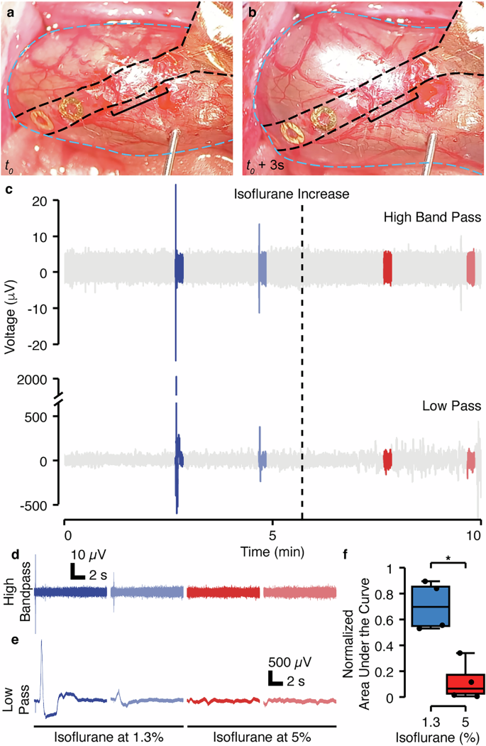Fig. 2: Conformable electronics enable in vivo acquisition of gut electrophysiological responses to in vivo mechanical stimuli.