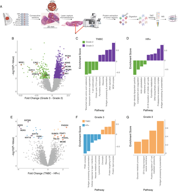 Fig. 1: Multi-region MS-based proteomics elucidates proteomic differences associated with tumor histopathology.