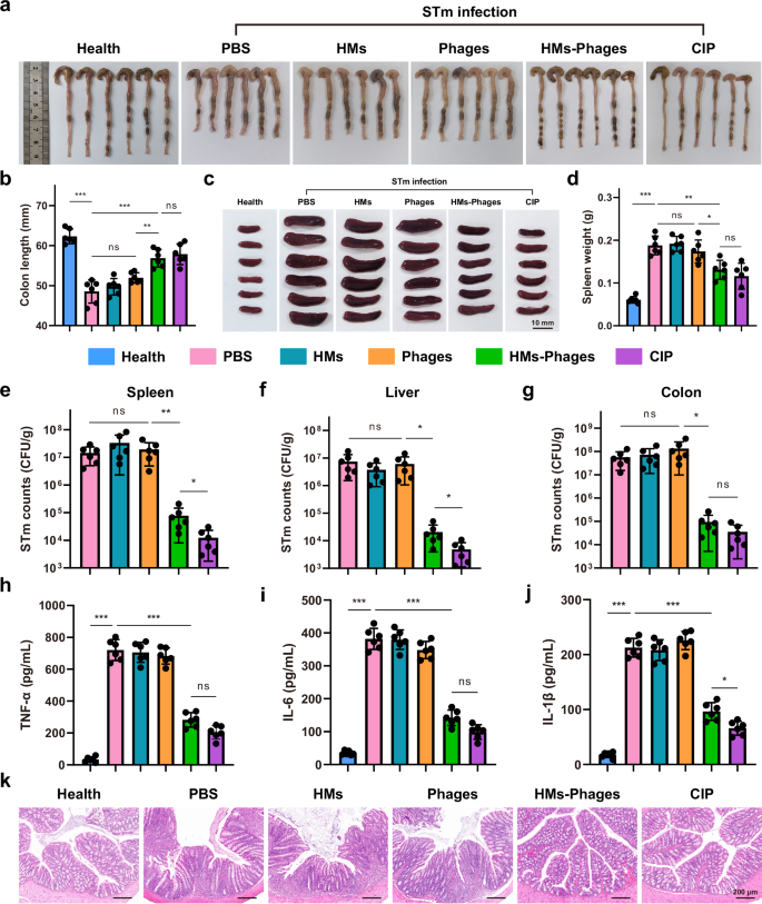 Fig. 7: Antibacterial efficacy of HMs-Phages on STm-induced colitis in mice.