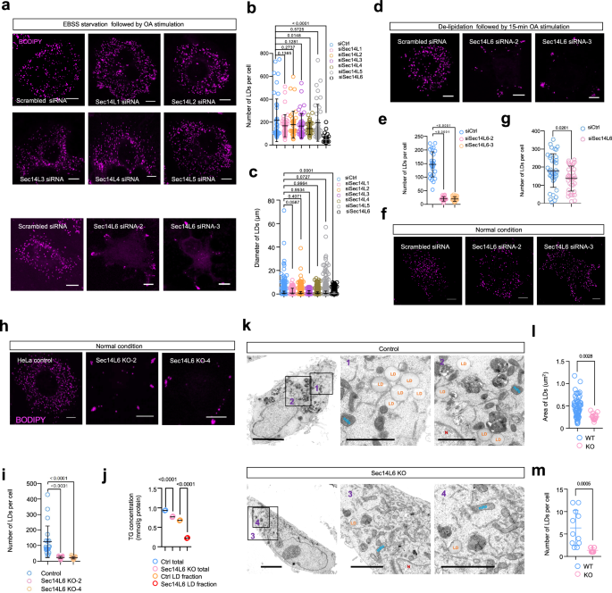 Fig. 1: Depletion of Sec14L6 impairs the formation of LDs.