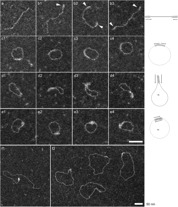 Fig. 5: Positive stain of Ku-Mtb.