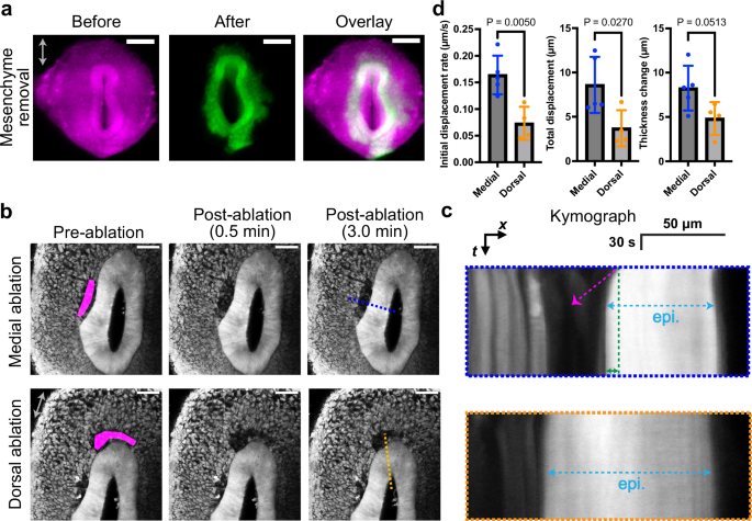 Fig. 2: Constrictive mesenchymal force deforms the epithelium during TES.