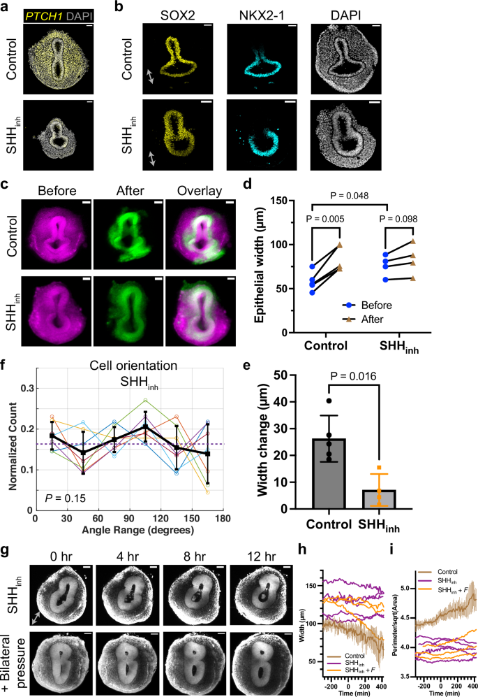 Fig. 6: SHH signaling is essential for generating the convergent mesenchymal force.