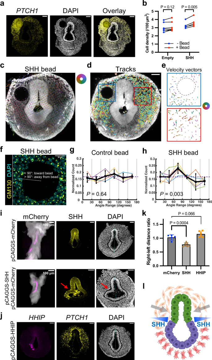 Fig. 8: SHH attracts the foregut mesenchymal cells to deform the epithelium.