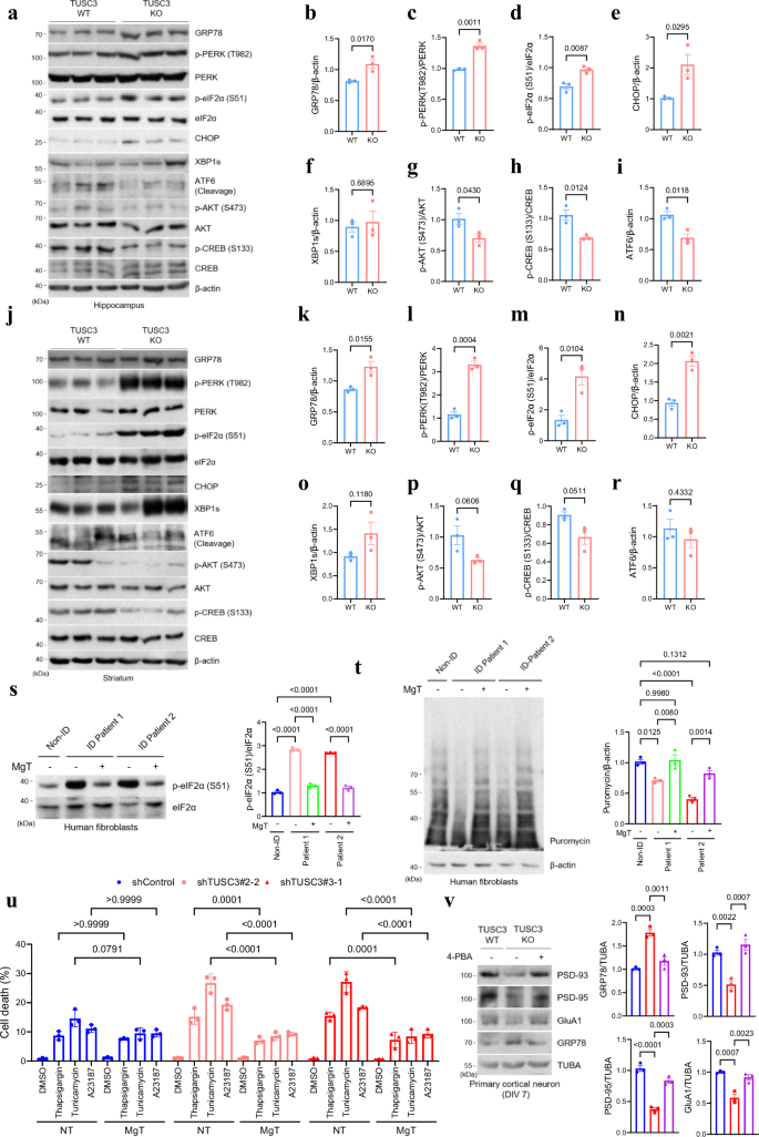 Fig. 3: TUSC3 loss induces ER stress via PERK-eIF2α pathway, leading to impaired protein translation and cell death.